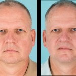 Front view of before and after cosmetic surgery for men
